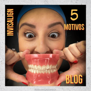 5 motivos para escolher Invisalign