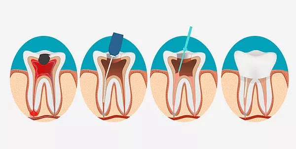 Endodontia