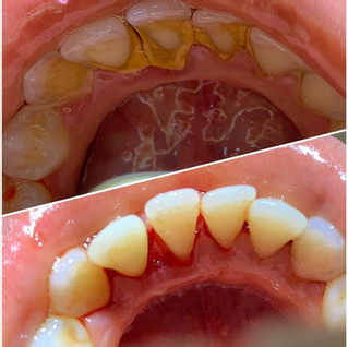 Periodontia