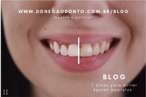 Sete dicas para evitar dentes amarelados