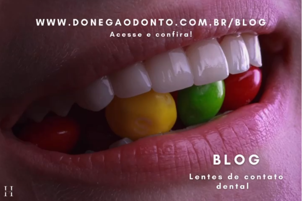 Lente de contato dental: saúde e autoestima