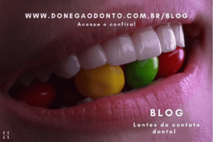 Lente de contato dental: saúde e autoestima