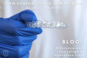 As diferenças entre o Invisalign e os aparelhos tradicionais ortodônticos