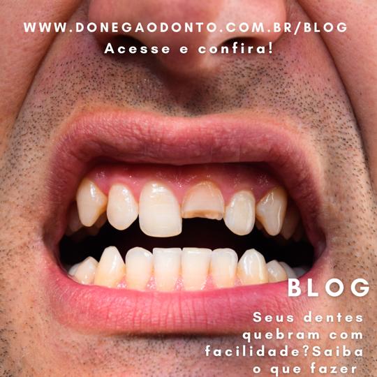 Seus dentes quebram com facilidade? Saiba o que fazer!