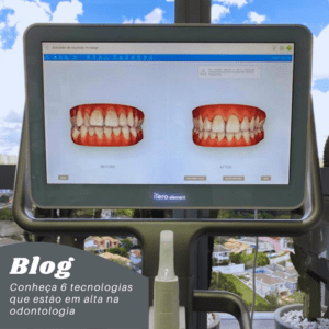 Conheça as 6 tecnologias que estão em alta na odontologia