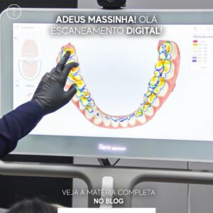 foto de escaneamento 3d dentário realizado na Donegá Odonto Alphaville.